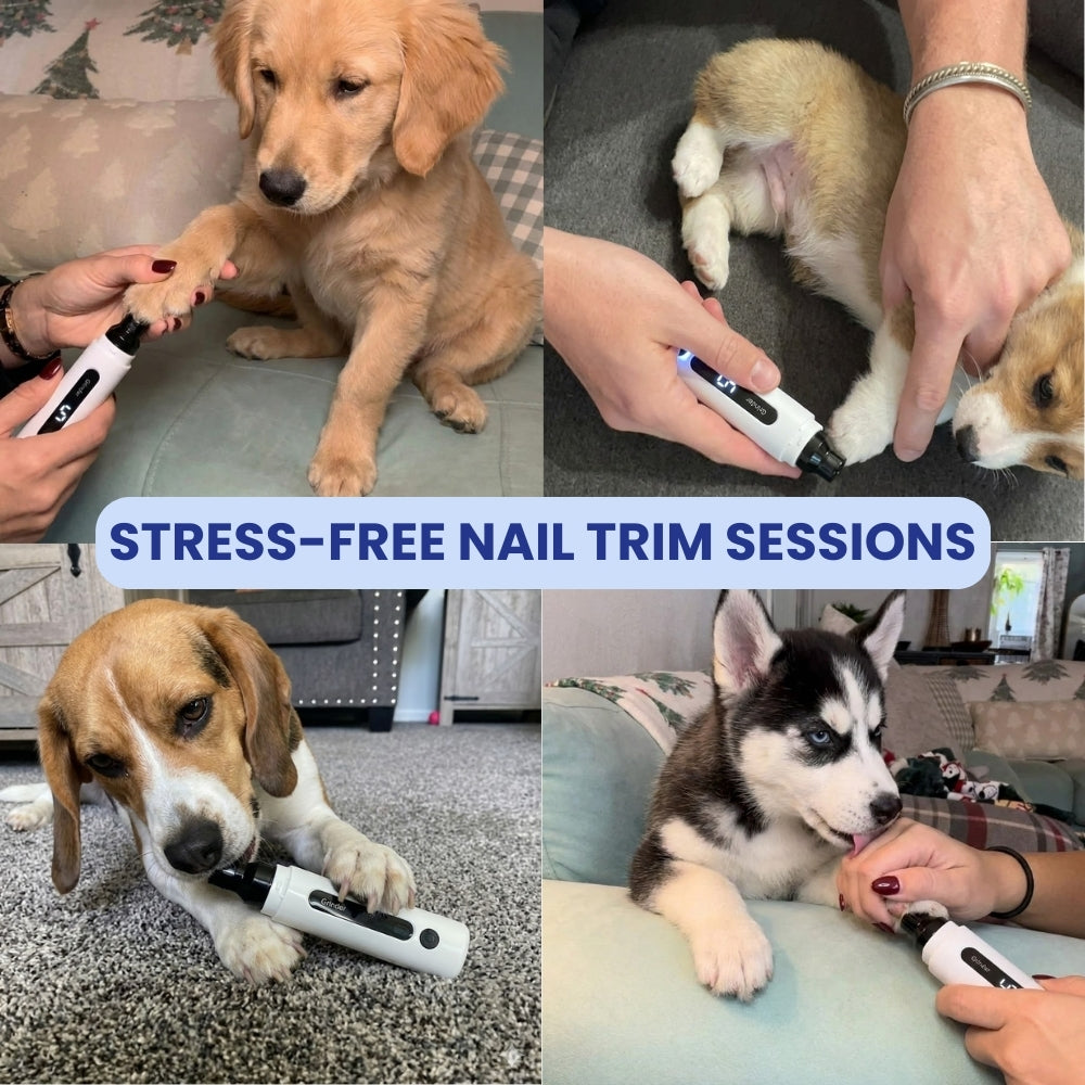WhisperTrim™ Pro Nail Trimming Kit