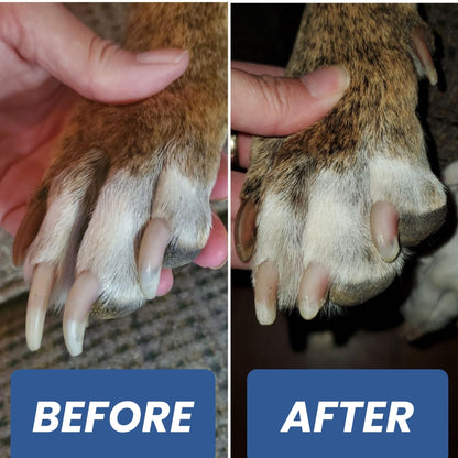 WhisperTrim™ Pro Nail Trimming Kit